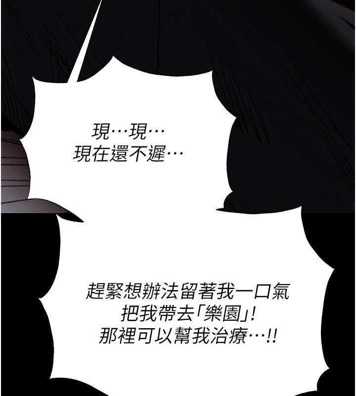 末日鵰堡第47話-這可是活生生移植的眼睛