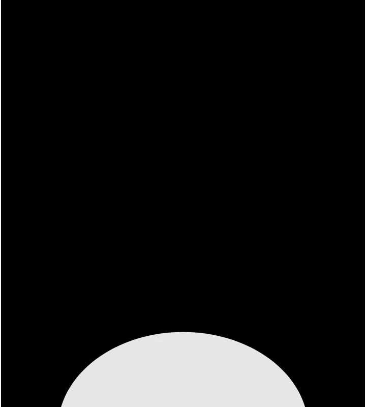 末日鵰堡第47話-這可是活生生移植的眼睛